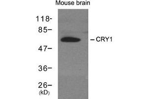 Western blot analysis of extracts from mouse brain tissue using CRY1 antibody. (CRY1 Antikörper)