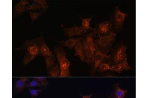 Immunofluorescence analysis of HeLa cells using DMD Polyclonal Antibody at dilution of 1:100. (Dystrophin Antikörper)