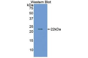 Western Blotting (WB) image for anti-Matrix Metallopeptidase 9 (Gelatinase B, 92kDa Gelatinase, 92kDa Type IV Collagenase) (MMP9) (AA 225-390) antibody (ABIN7440398)