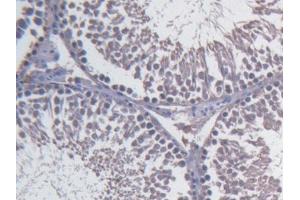 Immunohistochemistry (Paraffin-embedded Sections) (IHC (p)) image for anti-Fibulin 1 (FBLN1) (AA 347-521) antibody (ABIN5662147)