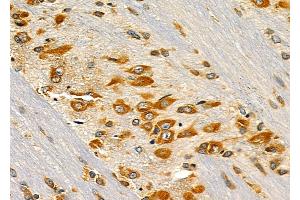 ABIN6261448 and ABIN6277528 at 1/100 staining Rat brain tissue by IHC-P.