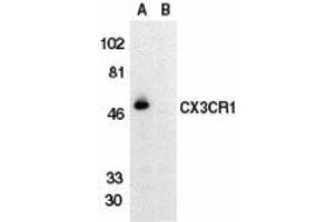 Western blot analysis of CX3CR1 in THP-1 cell lysate in the absence (lane A) or presence (lane B) of blocking peptide with AP30265PU-N CX3CR1 antibody at 1/500 dilution.