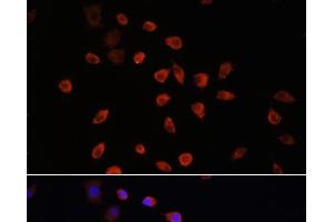 Immunofluorescence analysis of L929 cells using IFT88 Polyclonal Antibody at dilution of 1:100. (IFT88 Antikörper)