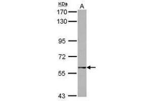 Image no. 1 for anti-GTP Binding Protein 2 (GTPBP2) (AA 1-179) antibody (ABIN1498565) (GTPBP2 Antikörper  (AA 1-179))