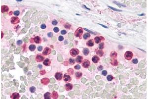 Human Neutrophils: Formalin-Fixed, Paraffin-Embedded (FFPE)