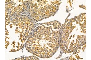 IL12B Mouse Monoclonal Antibody at 1/100 staining mouse testis tissue by IHC-P. (IL12B Antikörper  (C-Term))