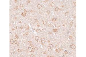 Immunohistochemistry of paraffin-embedded Rat brain using KCNJ4 Polyclonal Antibody at dilution of 1:100 (40x lens).