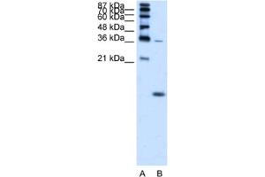 Western Blotting (WB) image for anti-Hemoglobin, zeta (HBZ) antibody (ABIN2462551)
