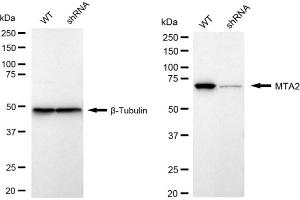 Western blotting analysis using MTA2 antibody (ABIN7799378). (Rekombinanter MTA2 Antikörper)