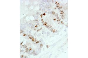 Immunohistochemistry (IHC) image for anti-Antigen Identified By Monoclonal Antibody Ki-67 (MKI67) (AA 1650-1700) antibody (ABIN7448620) (Ki-67 Antikörper  (AA 1650-1700))