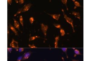 Immunofluorescence analysis of L929 cells using SSTR2 Polyclonal Antibody at dilution of 1:100 (40x lens). (SSTR2 Antikörper)