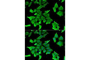Immunofluorescence analysis of HeLa cells using SPINT2 antibody. (SPINT2 Antikörper)