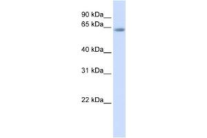 WB Suggested Anti-TCF7L2 Antibody Titration:  0. (TCF7L2 Antikörper  (Middle Region))