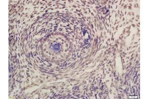 Formalin-fixed and paraffin embedded mouse embryo labeled with Rabbit Anti-CDK7 Polyclonal Antibody, Unconjugated (ABIN670251) at 1:200 followed by conjugation to the secondary antibody and DAB staining (CDK7 Antikörper  (AA 1-80))