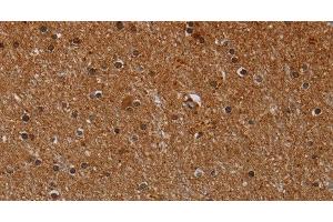 Immunohistochemistry of paraffin-embedded Human brain using CYP1A2 Polyclonal Antibody at dilution of 1:40 (CYP1A2 Antikörper)
