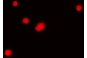 Immunofluorescent analysis of Fibrillarin staining in Hela cells. (Fibrillarin Antikörper)