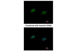 ICC/IF Image Immunofluorescence analysis of paraformaldehyde-fixed HeLa, using UBA2, antibody at 1:500 dilution. (UBA2 Antikörper  (N-Term))