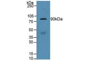 Detection of GSN in Human Serum using Polyclonal Antibody to Gelsolin (GSN) (Gelsolin Antikörper  (AA 432-625))