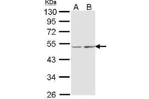 WB Image Sample (30 ug of whole cell lysate) A: A431 , B: Hela 10% SDS PAGE antibody diluted at 1:1000 (COX15 Antikörper  (Center))