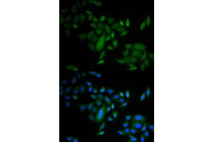 Immunofluorescence analysis of A549 cells using CASP9 antibody (ABIN5971434). (Caspase 9 Antikörper)
