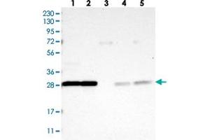 Western blot analysis of Lane 1: RT-4, Lane 2: U-251 MG, Lane 3: Human Plasma, Lane 4: Liver, Lane 5: Tonsil with YWHAQ polyclonal antibody . (YWHAB Antikörper)