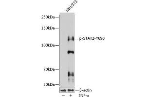 Western blot analysis of extracts of various cell lines, using Phospho-ST-Y690 pAb (ABIN3020024, ABIN3020025, ABIN3020026 and ABIN6225501) at 1:1000 dilution. (STAT2 Antikörper  (pTyr690))