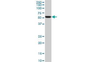 CDK8 monoclonal antibody (M01), clone 6H5. (CDK8 Antikörper  (AA 375-464))