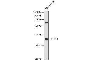 Western blot analysis of extracts of Mouse brain, using PHF11 antibody (ABIN6128437, ABIN6145533, ABIN6145535 and ABIN6217420) at 1:500 dilution. (PHF11 Antikörper  (AA 1-292))
