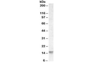 Western blot testing of human cerebellum lysate with Noxa antibody at 0. (NOXA Antikörper)