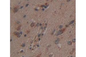 IHC-P analysis of Human Tissue, with DAB staining. (CNDP1 Antikörper  (AA 332-507))