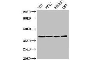 Western Blot Positive WB detected in: PC-3 whole cell lysate, K562 whole cell lysate, HEK293 whole cell lysate, U87 whole cell lysate All lanes: SLAMF1 antibody at 3 μg/mL Secondary Goat polyclonal to rabbit IgG at 1/50000 dilution Predicted band size: 38, 34, 41 kDa Observed band size: 38 kDa (SLAMF1 Antikörper  (AA 69-204))