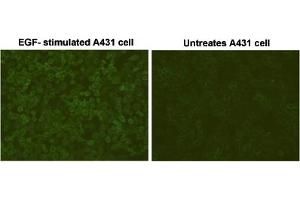 Immunofluorescent staining of EGF-stimulated A431 cells and untreated A431 cells with Phosphotyrosine monoclonal antibody, clone E10 . (Phosphotyrosine Antikörper)
