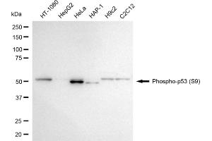 Western blotting analysis using phospho-p53 (S9) antibody (ABIN7800684).