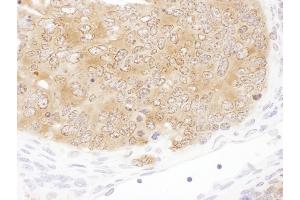 Immunohistochemistry (IHC) image for anti-serine Hydroxymethyltransferase 1 (Soluble) (SHMT1) (AA 453-483) antibody (ABIN7455015) (SHMT1 Antikörper  (AA 453-483))