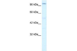 Human Jurkat; WB Suggested Anti-ZNF409 Antibody Titration: 0. (ZFHX2 Antikörper  (Middle Region))