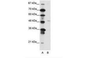 Image no. 1 for anti-Mesenchyme Homeobox 2 (MEOX2) (N-Term) antibody (ABIN202200)