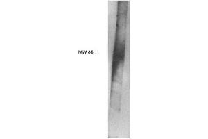 Image no. 1 for anti-Phosphatidic Acid Phosphatase Type 2B (PPAP2B) antibody (ABIN4620345) (PPAP2B Antikörper)
