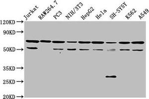 Western Blot Positive WB detected in: Jurkat whole cell lysate, RAW264. (NUP62 Antikörper  (AA 173-522))