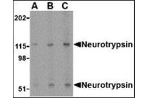 Western blot analysis of neurotrypsin in SK-N-SH cell lysate with this product at (A) 0. (Neurotrypsin Antikörper  (N-Term))