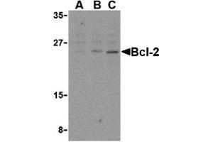 Western Blotting (WB) image for anti-B-Cell CLL/lymphoma 2 (BCL2) (Middle Region) antibody (ABIN1030884) (Bcl-2 Antikörper  (Middle Region))