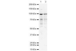 Image no. 1 for anti-Transporter 1, ATP-Binding Cassette, Sub-Family B (MDR/TAP) (TAP1) antibody (ABIN108593) (TAP1 Antikörper)