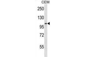 Western Blotting (WB) image for anti-Rhomboid 5 Homolog 2 (RHBDF2) antibody (ABIN5017025) (RHBDF2 Antikörper)