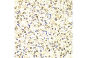 Immunohistochemistry of paraffin-embedded rat heart using DDB2 antibody at dilution of 1:100 (x400 lens). (DDB2 Antikörper)