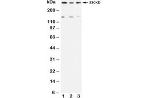 Western blot testing of ATM antibody and Lane 1:  rat testis;  2: U87;  3: MCF-7 (ATM Antikörper  (N-Term))