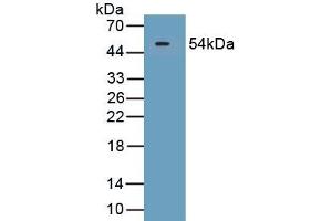 Detection of Recombinant SECTM1, Human using Polyclonal Antibody to Secreted And Transmembrane Protein 1 (SECTM1) (SECTM1 Antikörper  (AA 29-248))