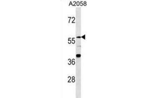 Western Blotting (WB) image for anti-Zinc Finger Protein 776 (ZNF776) antibody (ABIN3000161) (ZNF776 Antikörper)