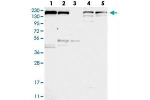 Western blot analysis of Lane 1: RT-4, Lane 2: U-251 MG, Lane 3: Human Plasma, Lane 4: Liver, Lane 5: Tonsil with UGCGL1 polyclonal antibody . (UGGT1 Antikörper)