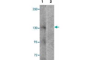 Western blot analysis of NLRP7 in human brain tissue lysate with NLRP7 polyclonal antibody  at 1 ug/mL in (1) the absence and (2) the presence of blocking peptide. (NLRP7 Antikörper  (N-Term))
