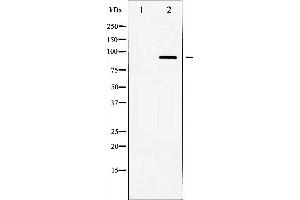 Western blot analysis of HSL expression in Jurkat whole cell lysates,The lane on the left is treated with the antigen-specific peptide.