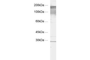 dilution: 1 : 1000, sample: crude synaptic membranes fraction of rat brain (LP1) (Regulating Synaptic Membrane Exocytosis 1 (RIMS1) (AA 955-1156) Antikörper)